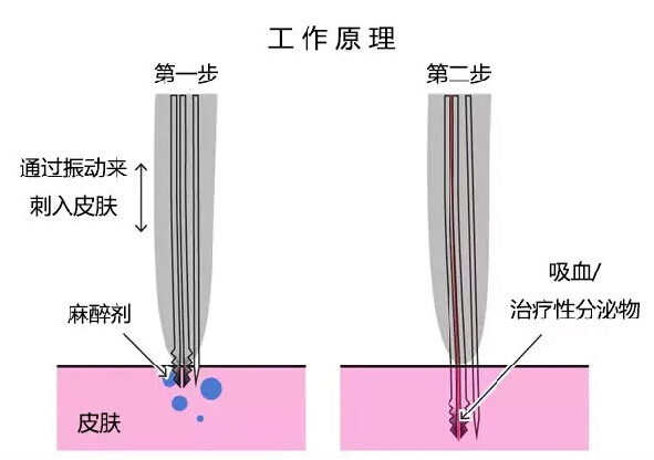 為了生態(tài)，荷蘭人很會有效利用昆蟲資源